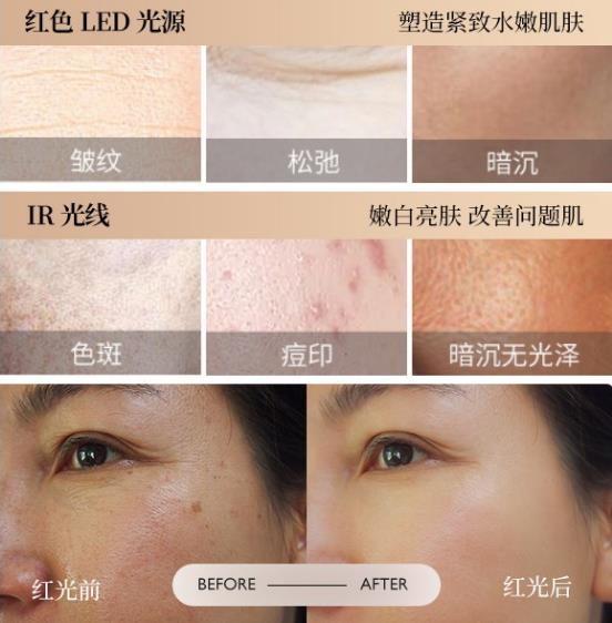 時光之謎美容儀,將光療抗衰新技術帶入百姓生活