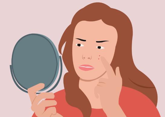 鼻子上長(zhǎng)膿包型痘痘可以擠嗎??jī)擅贾虚g長(zhǎng)痘怎么調(diào)理?