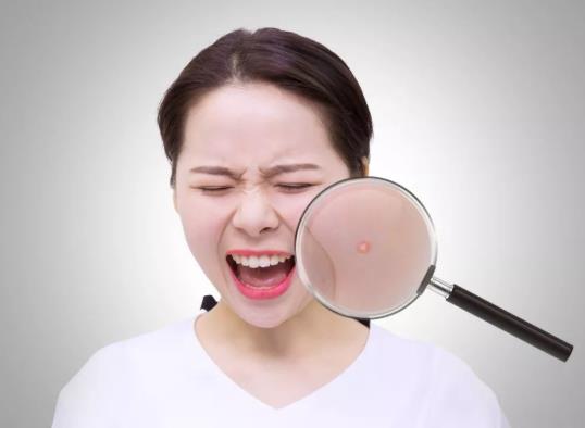 擠痘痘顱內(nèi)感染會(huì)死嗎?擠痘痘顱內(nèi)感染多久能看出來(lái)?