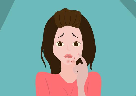 擠痘痘顱內感染能治愈嗎?擠了三角區域的痘痘怎么避免感染