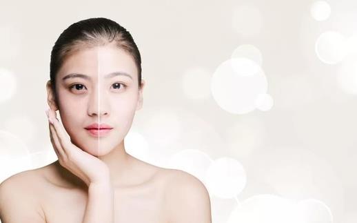 光子嫩膚2年后毛孔越來(lái)越大是真的嗎?m22光子嫩膚后悔了怎么回事