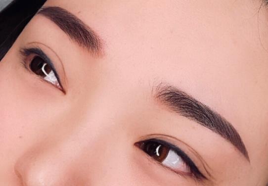 眉毛上長痘痘是什么原因?眉心長痘痘是什么原因?