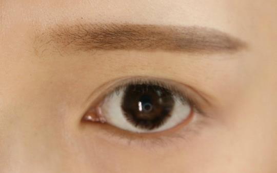 眉毛長痘痘怎么辦?兩眉中間長痘如何調(diào)理?