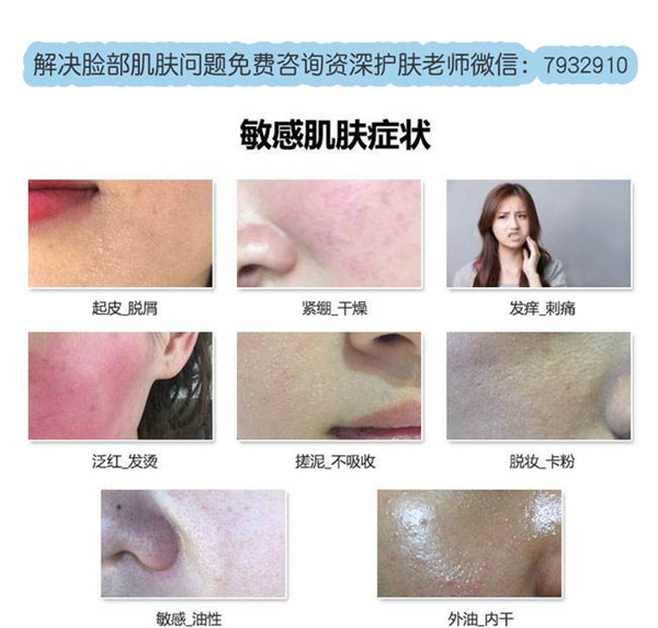 臉過敏癢怎么處理?用朵嘉濃告別秋冬季臉過敏!