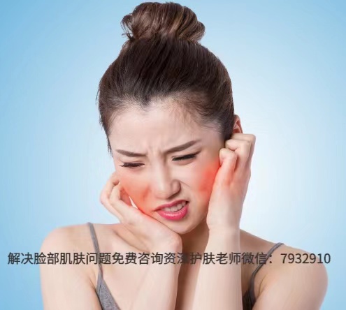 臉過敏癢怎么處理?用朵嘉濃告別秋冬季臉過敏! 752093227985955108.jpg