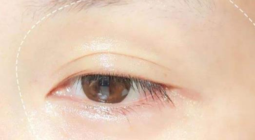 節后疲勞肌膚要做好護理 這些節后疲勞肌膚的護理方法要收好