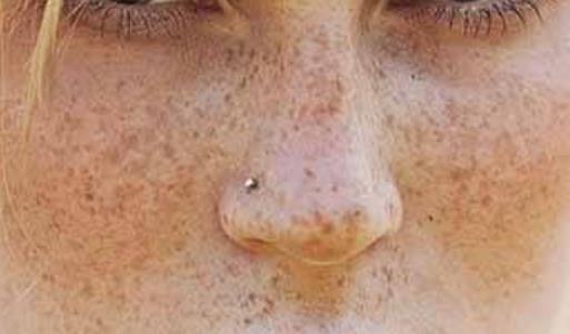 肌膚七大隱患注意好 這些方法送給你
