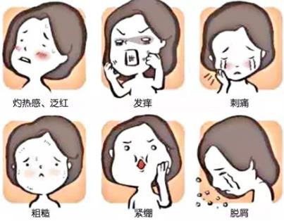 激素臉有哪些癥狀表現(xiàn)?解答激素臉?lè)磸?fù)總不好怎么辦