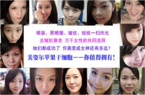 眼袋黑眼圈怎么消除 改善黑眼圈的最好方法