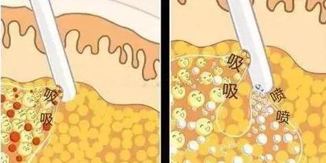 美貝爾整形醫院正規嗎 愛心醫院公益為民