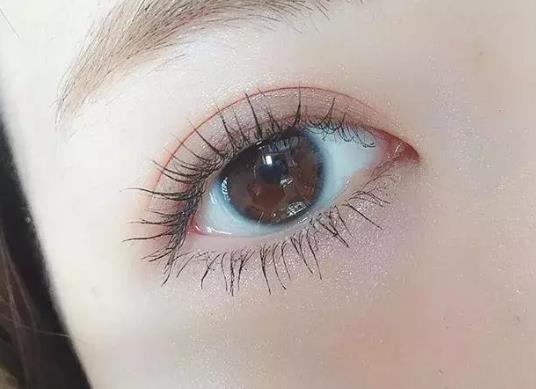 眼皮松弛能做雙眼皮嗎?全切雙眼皮幾年后會變自然?