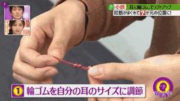伊美爾愛康醫院自體脂肪填充效果好不好?