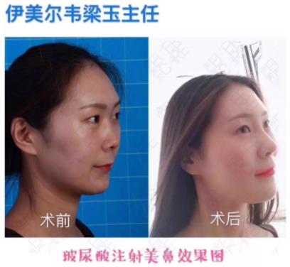北京伊美爾愛康韋梁玉醫(yī)生靠譜嗎?喚醒嬌嫩美肌