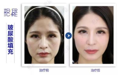 北京伊美爾愛康韋梁玉醫(yī)生靠譜嗎?喚醒嬌嫩美肌