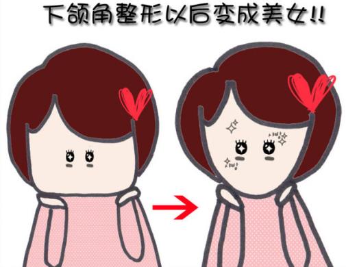 下頜角整形手術的適應癥-下頜角整形手術的注意事項
