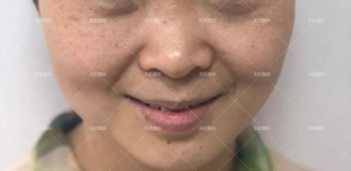 鄭州天后醫(yī)療美容醫(yī)院好嗎 點(diǎn)燃您的靚麗豐采