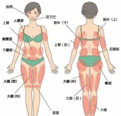 吸脂術會反彈嗎 吸脂的后遺癥是什么 吸脂術不能替代科學減肥
