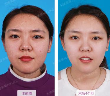 天津美萊醫院正規嗎 熱心服務 真心對待 衷心祝福