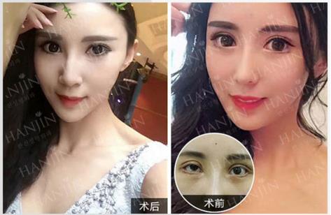 昆明韓辰楊瑞年院長(zhǎng) 整形醫(yī)生也要講醫(yī)德