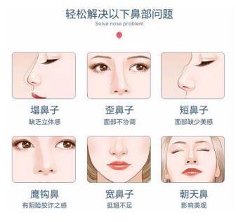 福州米蘭整形如何 為你訂制個性化的塑美方案
