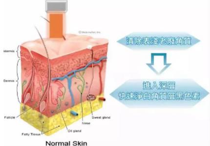 北京伊美爾健翔醫院:玻尿酸除皺的價格