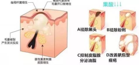 北京伊美爾健翔醫院:玻尿酸除皺的價格