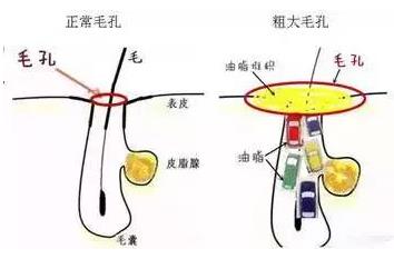 北京伊美爾愛康醫(yī)院: 點陣激光多久恢復
