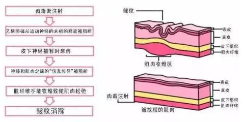 北京伊美爾健翔醫院:玻尿酸除皺的價格