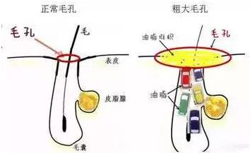 北京伊美爾愛康醫院:春季皮膚問題有哪些?