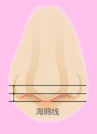 福州格萊美醫院隆鼻:鐘德成院長解析3+3立挺半肋鼻綜合