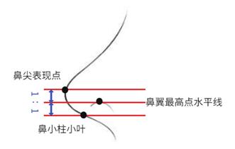 福州格萊美醫院隆鼻:鐘德成院長解析3+3立挺半肋鼻綜合