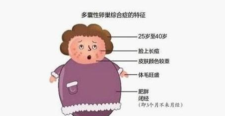 女性減肥太難了!“多囊患者”為什么不要盲目減肥? image.png