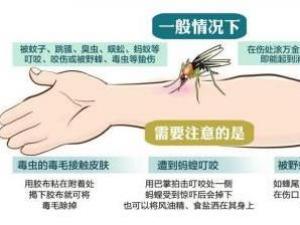 被毒蚊子咬了怎么辦？蚊子咬了怎么消腫止癢
