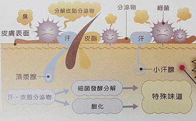 狐臭會傳染嗎?體臭和狐臭的區別