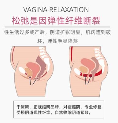 縮陰提肛運動怎么做 分享正確的步驟和技巧