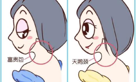 e+more醫(yī)加摩丨富貴包不痛不癢,當(dāng)心變成“奪命包”!