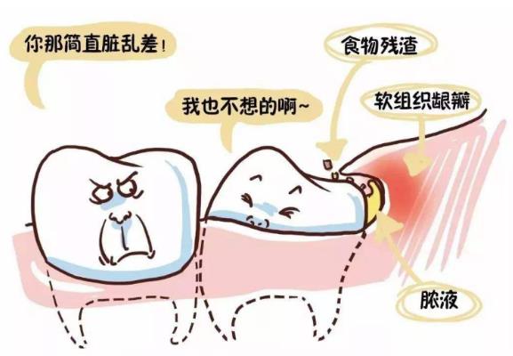 發炎疼痛的智齒為什么不能立刻拔掉?智齒一定要拔嗎?