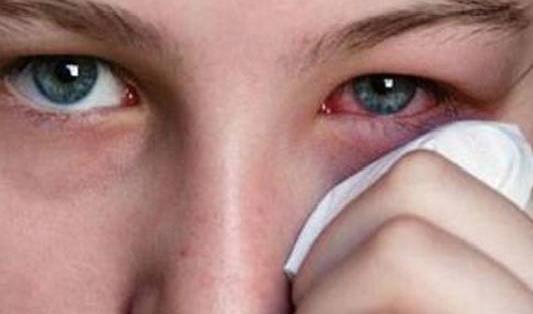 眼睛浮腫的原因有哪些?眼睛浮腫怎么消除?