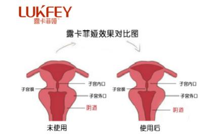想緊致!縮陰產品到底能不能用