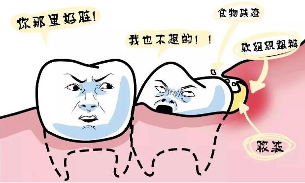 全民愛牙公益-智齒牙發炎有哪些炎癥呢