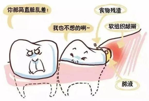 全民愛牙公益行動告訴您這些牙齒疼痛是智齒鬧的