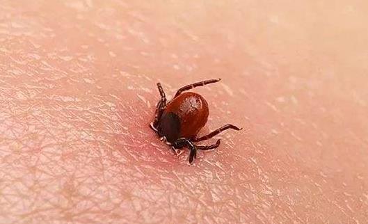 什么是蜱蟲?被蜱蟲有哪些癥狀?