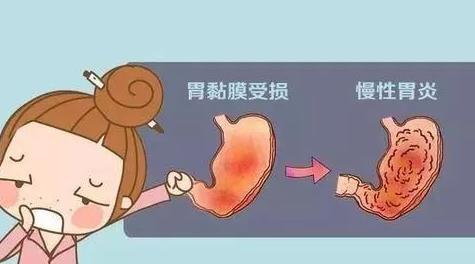 中醫胃腸專家徐崇偉,慢性胃炎的中醫辨證