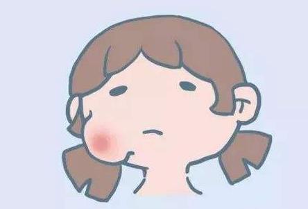 如何預防流行性腮腺炎?流行性腮腺炎的癥狀是什么