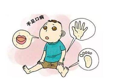 如何預防手足口病?手足口病的癥狀是什么