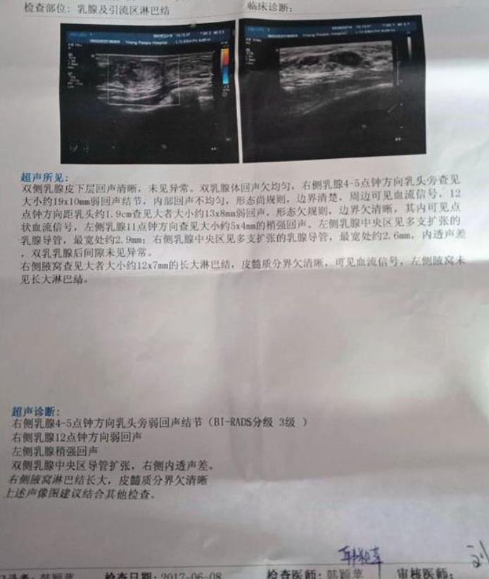 乳腺腫塊應怎么治療?康蓓詩乳康冷敷貼輕松康復不用愁
