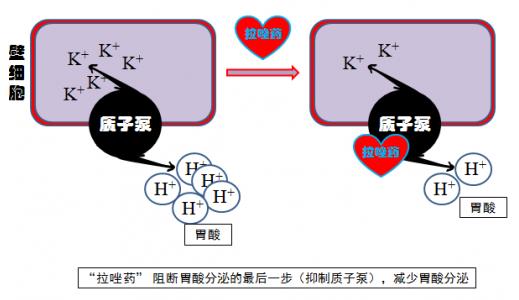 腸潰瘍發(fā)作怎么辦?選對藥物很重要