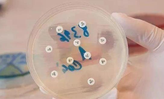 乳頭濕疹有哪些癥狀?為什么會患乳頭濕疹?