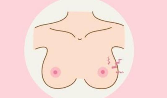 乳頭濕疹有哪些癥狀?為什么會患乳頭濕疹?
