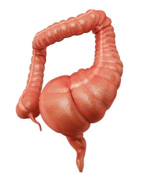 先天性巨結(jié)腸能根治嗎?先天性巨結(jié)腸的癥狀是什么